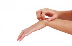 春季各种皮肤病泛滥,你了解哪一种?