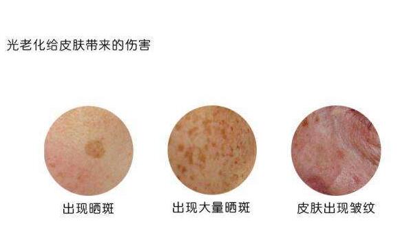 修复晒后肌肤,防止色斑入侵