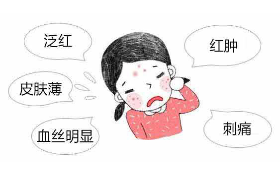 脸上出现红血丝该怎么办?如何修复红血丝?