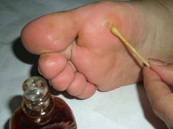 太原皮肤病医院